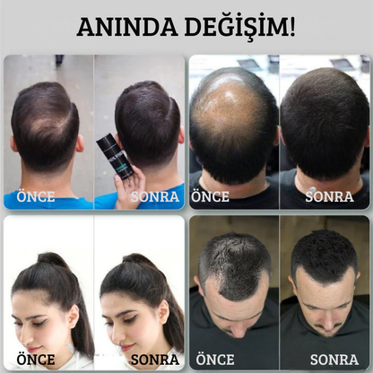 KÉLOR Premium Kalıcı Saç Fiberi (50 gr.)