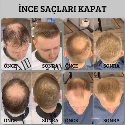 KÉLOR Premium Kalıcı Saç Fiberi (50 gr.)